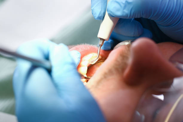 Best Emergency Denture Repair in Fort Knox, KY