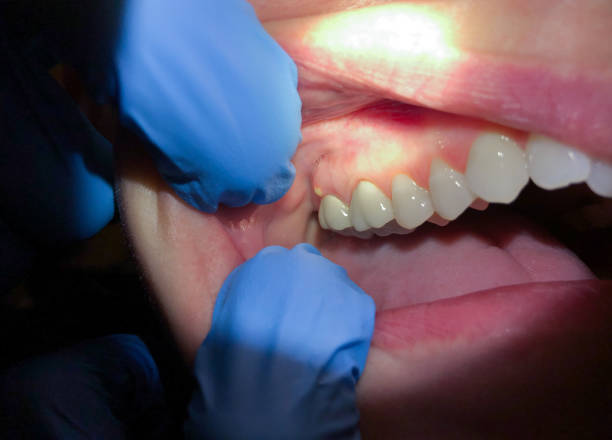 Best Pediatric Emergency Dentist in Fort Knox, KY